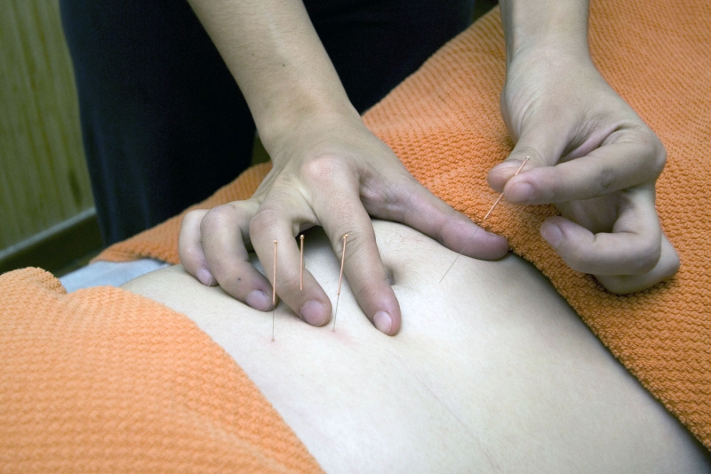 osteopathe-TOURVES-min_acupuncture-4175625